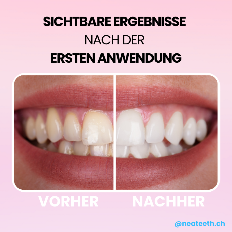 V34 Smile Paste