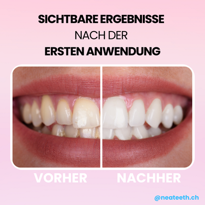 V34 Smile Paste